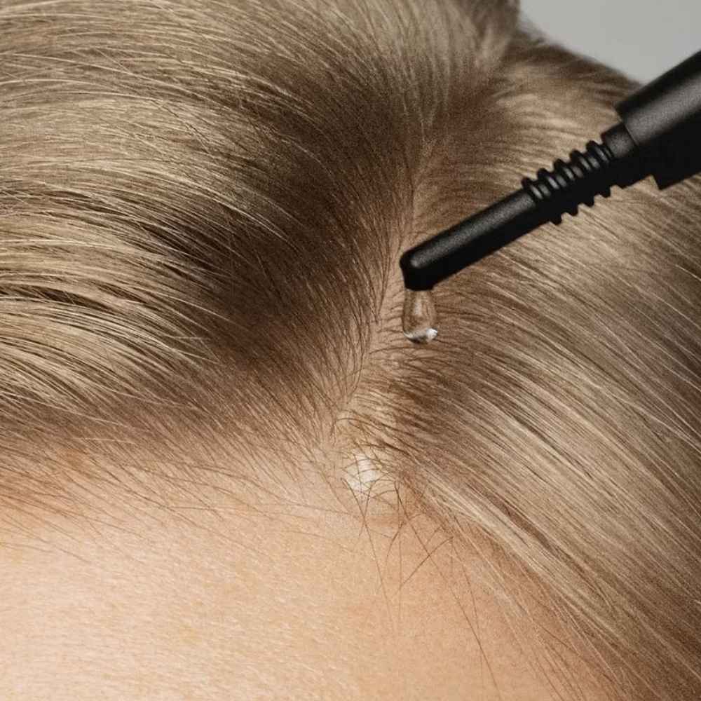 Scalp Peel Serum