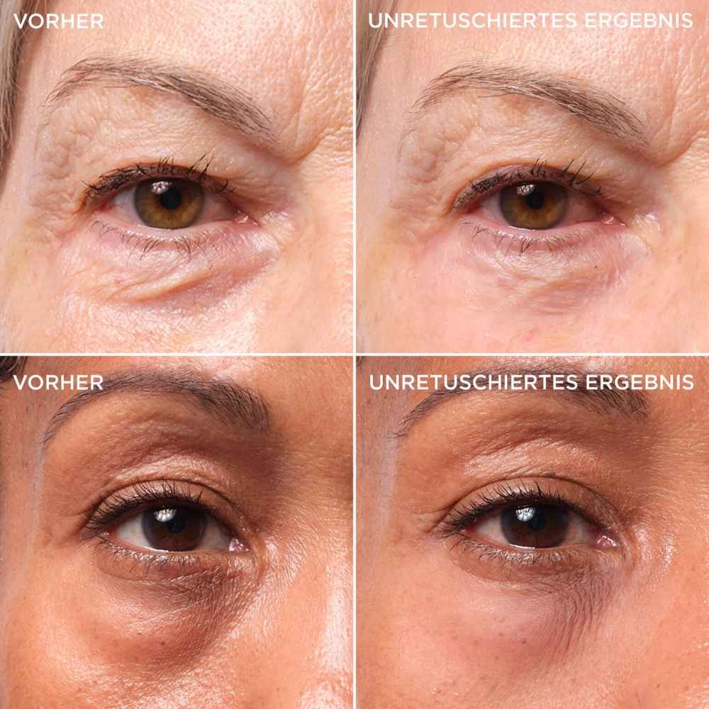 Bye Bye Under Eye Bags Augencreme